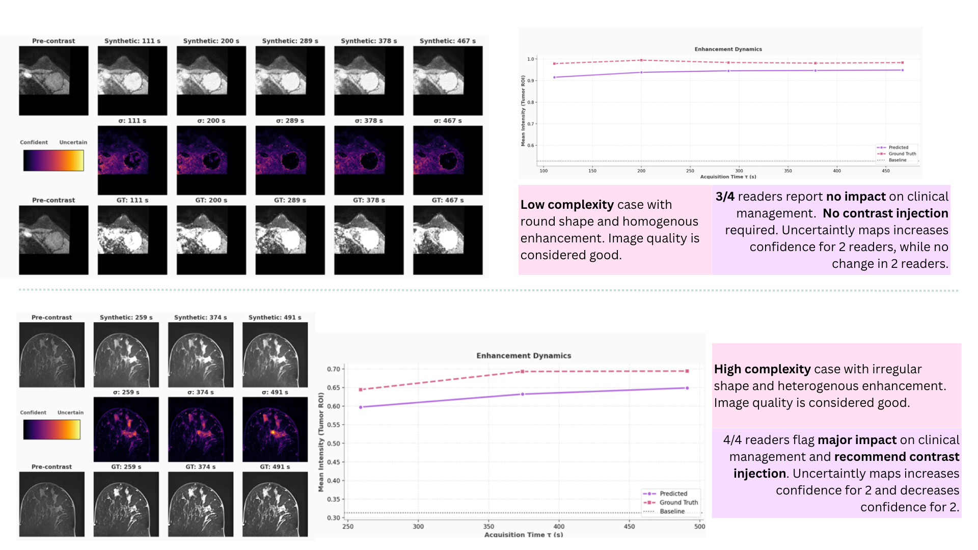 Reader study figure contrasting a low-complexity case and a high-complexity case, each showing pre-contrast baseline, predicted synthetic time series, pixel-wise uncertainty maps, ground truth series, and kinetic enhancement plots.